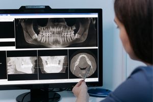 Customized Solutions for dental implants :