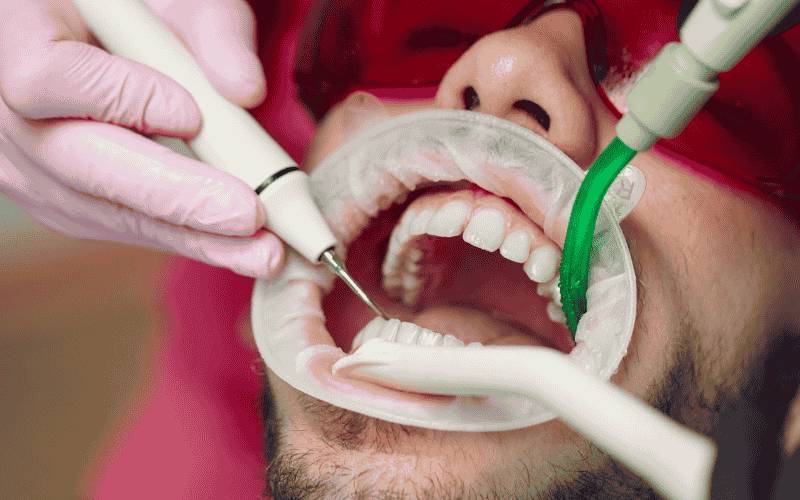 shaving teeth