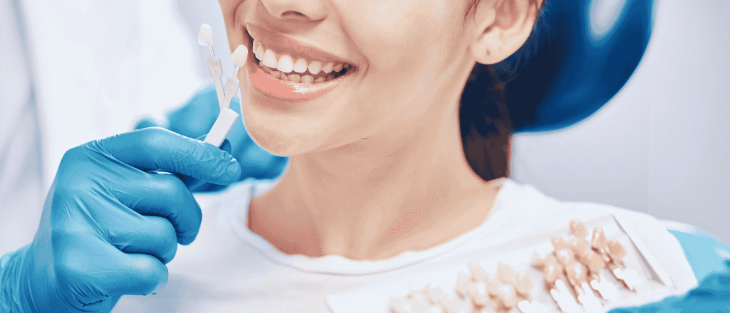 veneers without shaving teeth