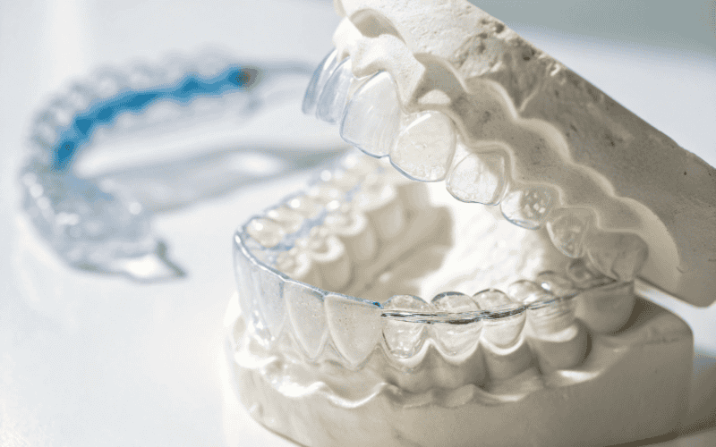 Looking for the Best Gum Grafting in Turkey? Teeth implants Turkey Offers Expert Care for a Perfect Smile