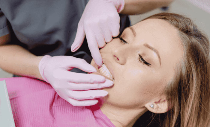 Why Experts Now Say Not to Remove Your Wisdom Teeth