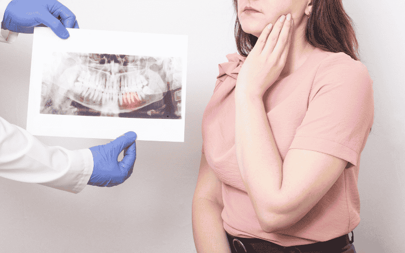 Impacted Wisdom Teeth