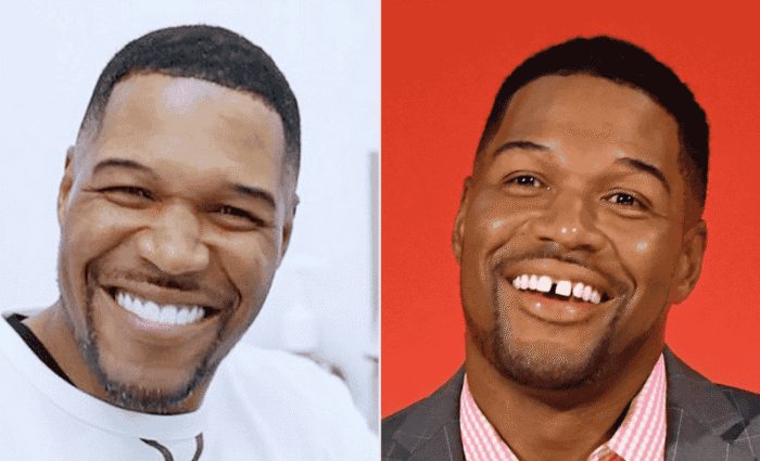 Michael Strahan Teeth