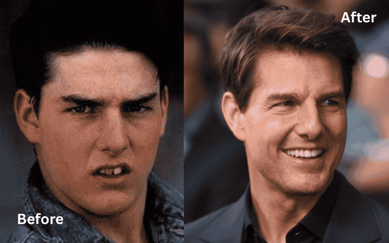 Tom Cruise before and after teeth