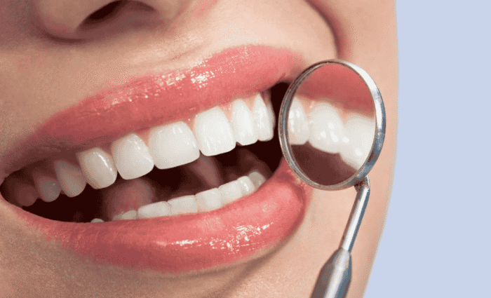 Turkey Teeth Trend