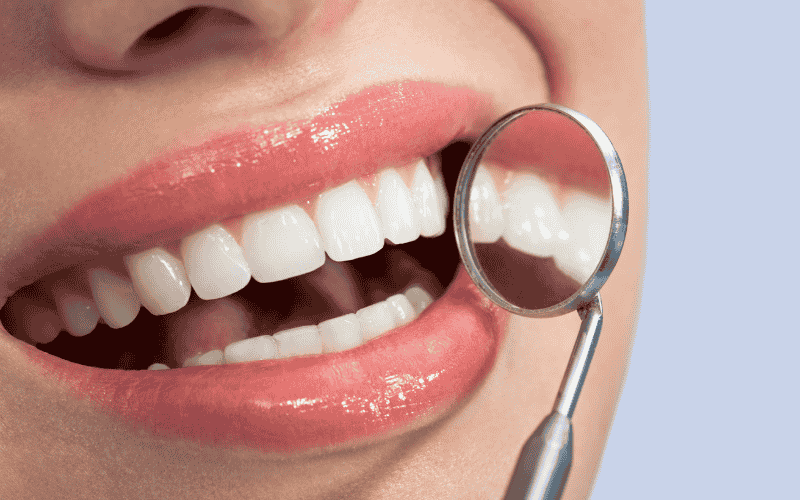 Turkey Teeth Trend
