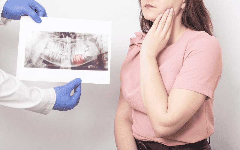 Wisdom Teeth Removal Side Effects