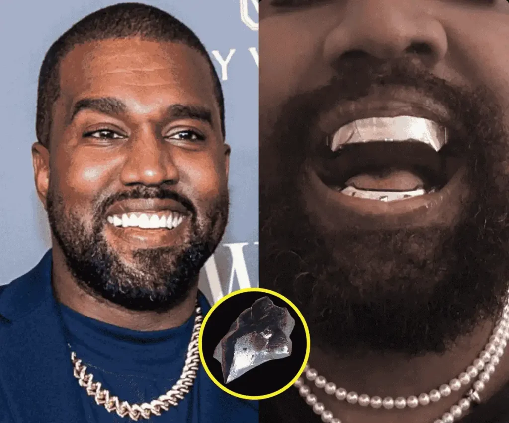 Kanye West New Teeth