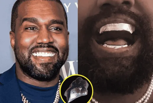 Kanye West New Teeth