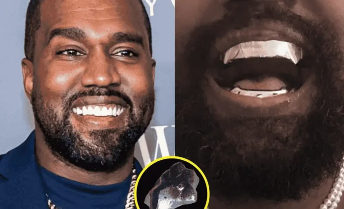 Kanye West New Teeth