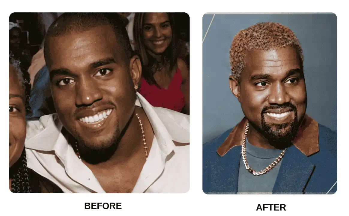 Kanye West New Teeth
